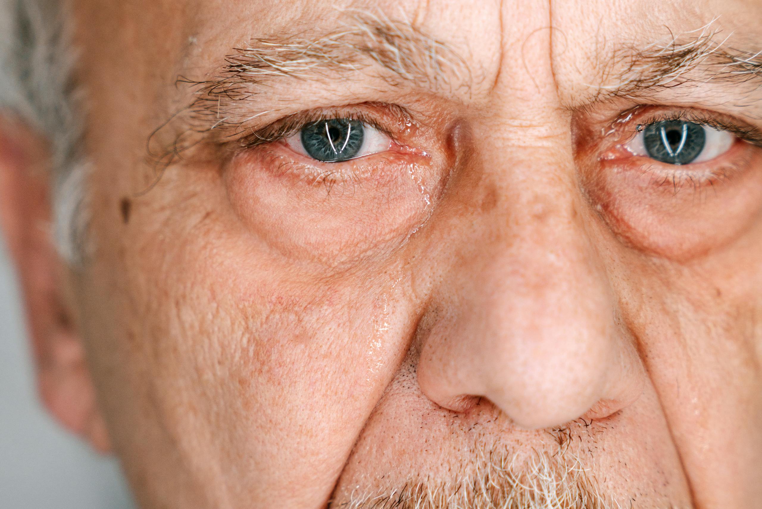Close-up of elderly man's face reflecting the impact of mesothelioma from asbestos exposure