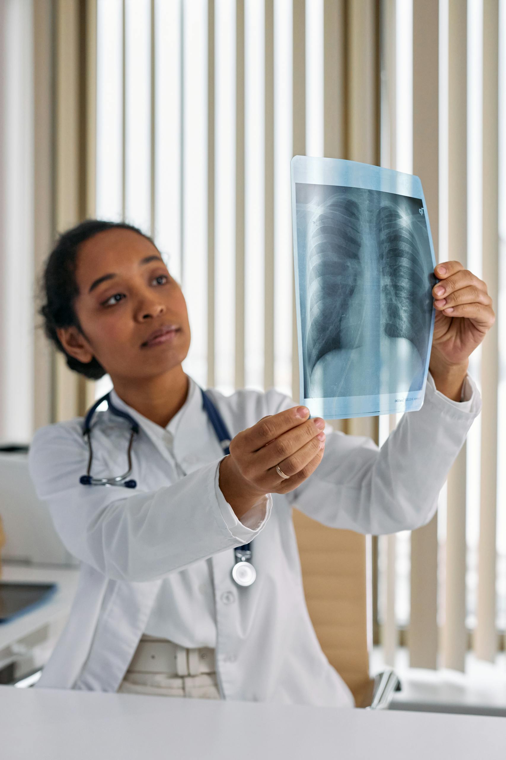 Doctor examining chest X-ray for signs of mesothelioma caused by asbestos exposure for a mesothelioma lawsuit